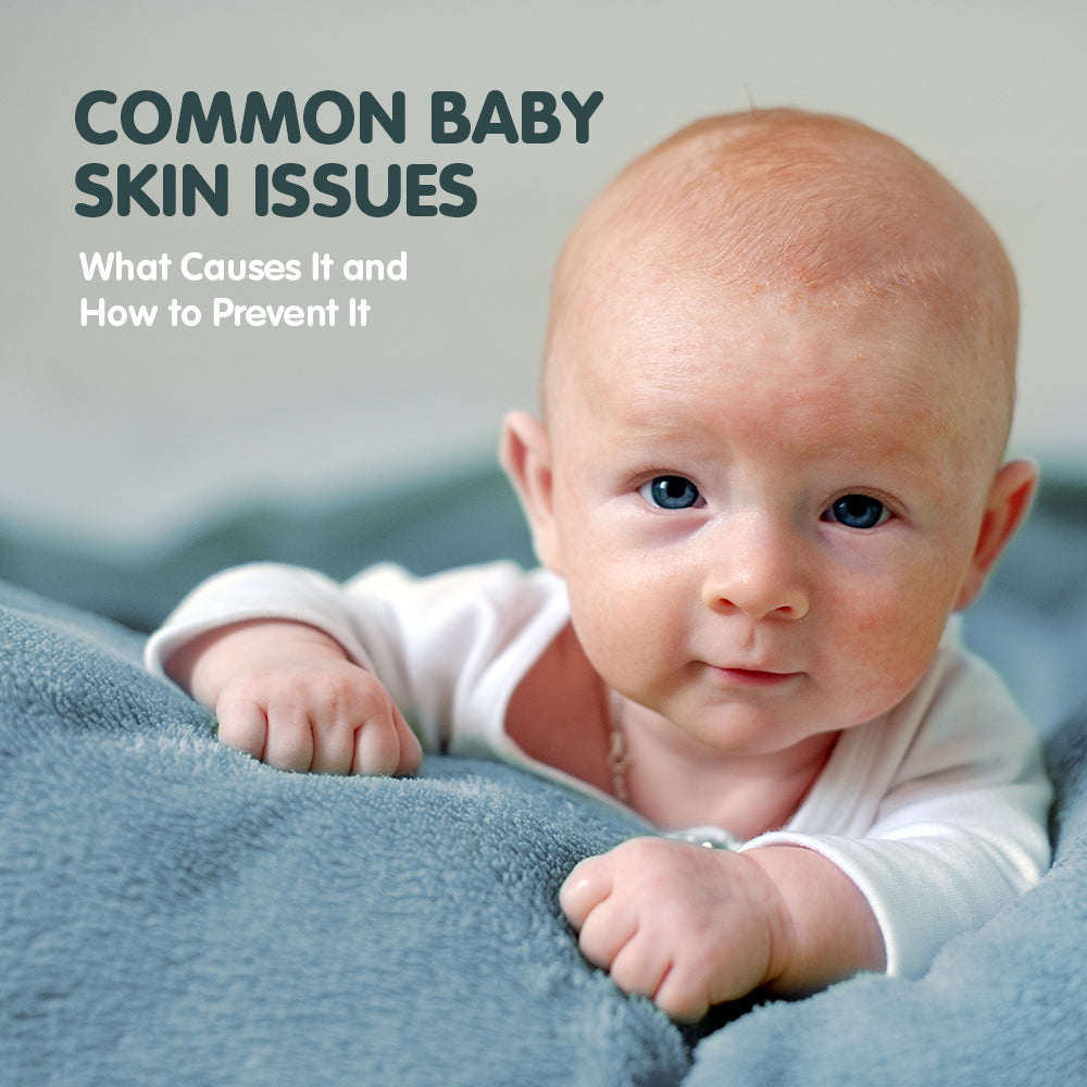 No Compromise Parenting: Common Baby Skin Issues